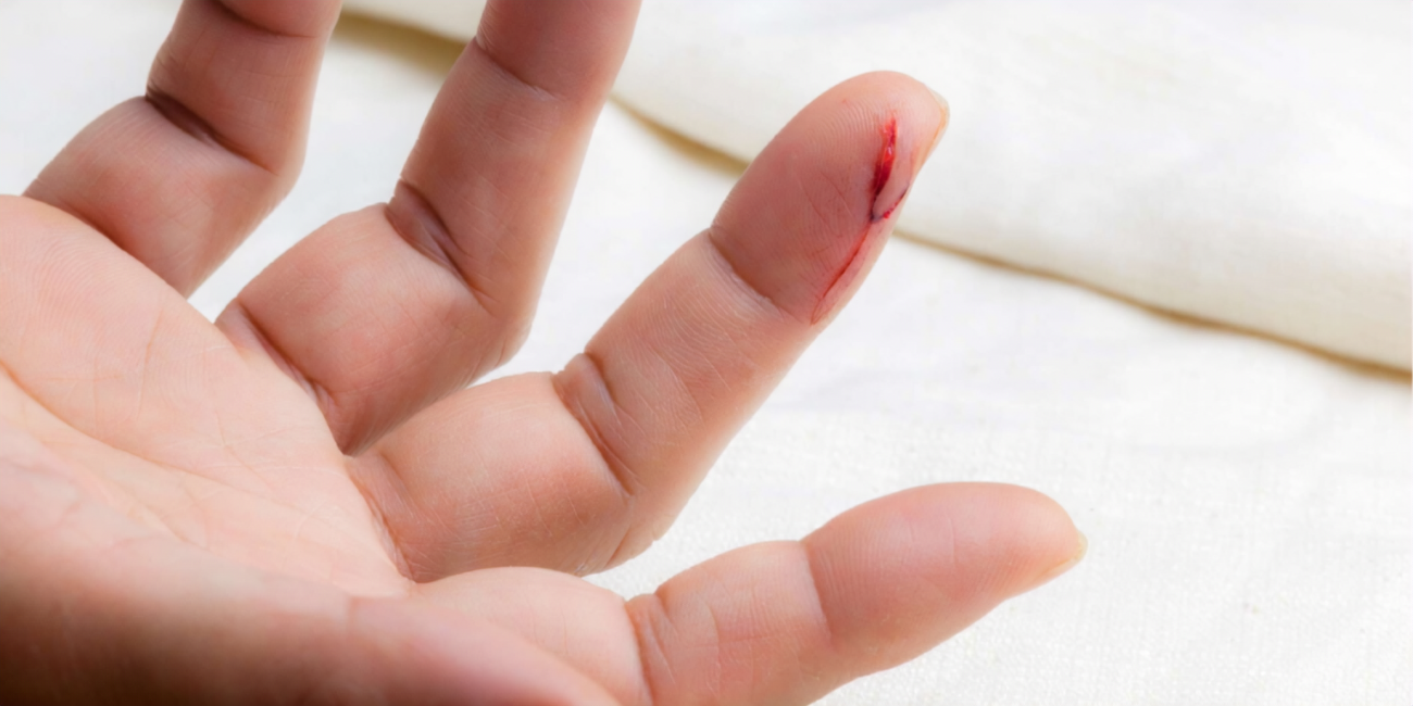 Child with cut/injury